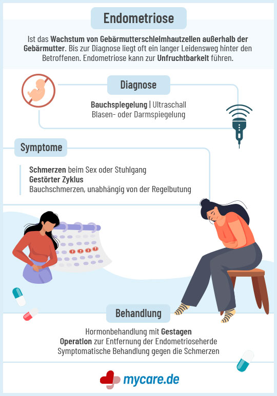 Infografik Endometriose: Diagnose, Symptome, Behandlung