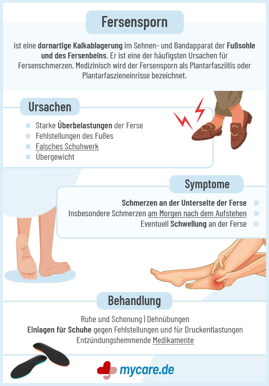 Infografik Fersensporn: Ursachen, Symptome und Behandlung