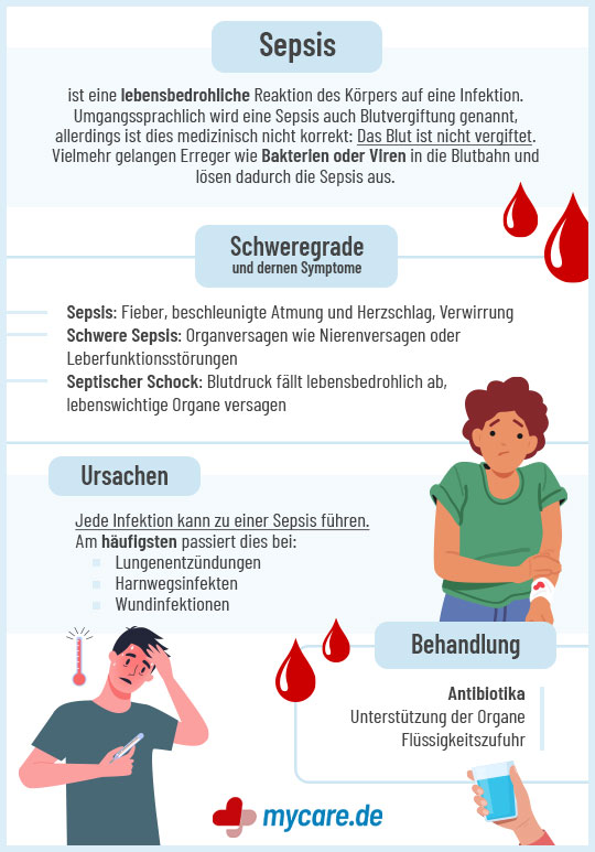 Infografik Sepsis: Schweregrad, Ursachen & Behandlung