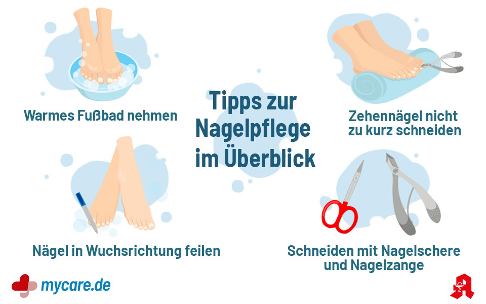Tipps zur Nagelpflege: warmes Fußbad nehmen, Zehennägel nicht zu kurz schneiden, Nägel in Wuchsrichtung feilen, Nägel mit Nagelschere und Nagelzange schneiden.