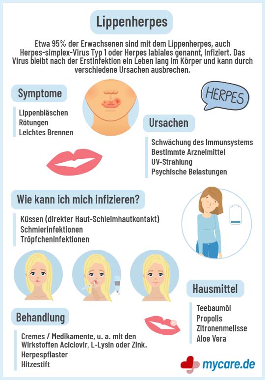 Infografik Lippenherpes: Symptome, Ursachen, Behandlung