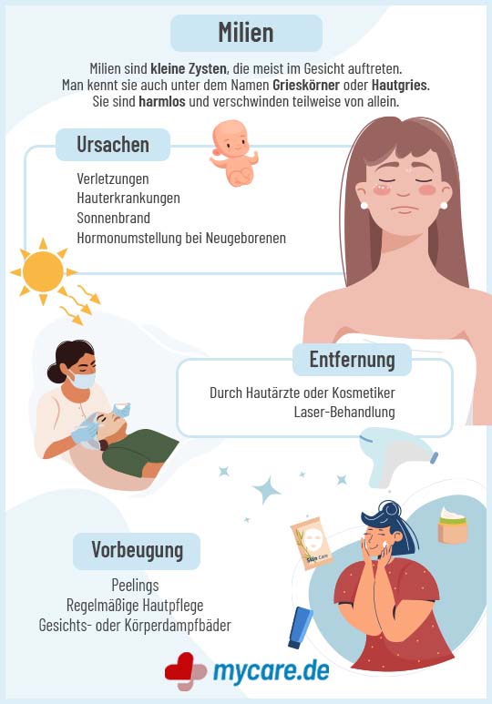 Infografik Milien: Ursachen, Symptome und Behandlung Infografik Milien: Ursachen, Symptome und Behandlung