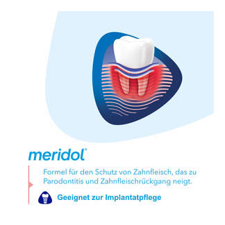 Meridol Parodont Expert Mundspülung Verwendung