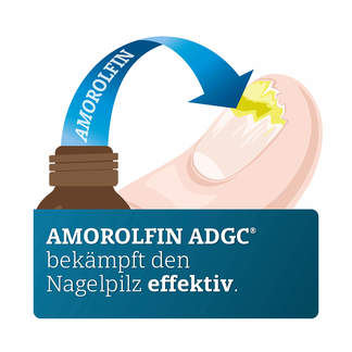 Grafik Amorolfin ADGC 50 mg/ml wirkstoffhaltiger Nagellack Wirkweise