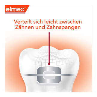 Grafik Elmex Zahnpasta Kariesschutz Professional + Zahnspange Verteilt sich leicht zwischen Zähnen und Zahnspangen