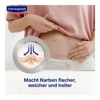 Grafik Hansaplast Pflaster zur Behandlung von Narben Macht Narben flacher, weicher und heller
