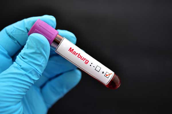 Ein Reagenzglas von einer Blutentnahme mit einem Etikett auf dem Marburg positiv steht.