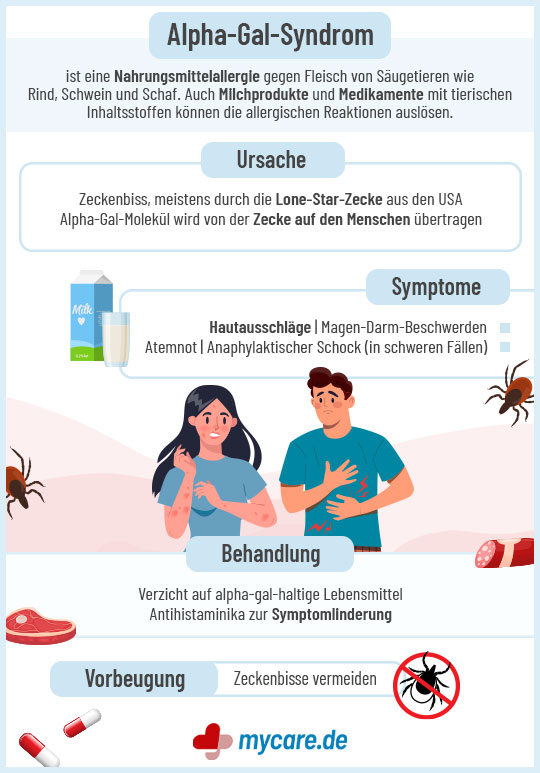 Infografik Alpha-Gal-Syndrom: Ursache, Symptome. Behandlung und Vorbeugung