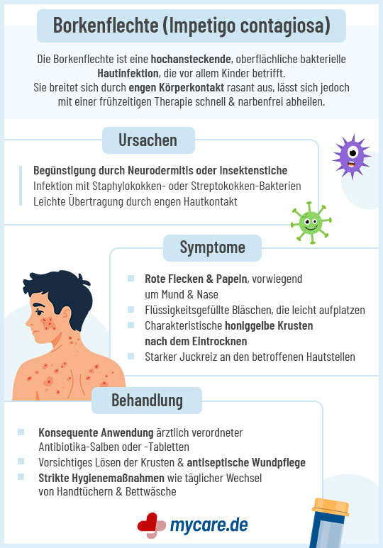 Infografik Borkenflechte: Ursachen, Symptome und Behandlung Infografik Borkenflechte: Ursachen, Symptome und Behandlung