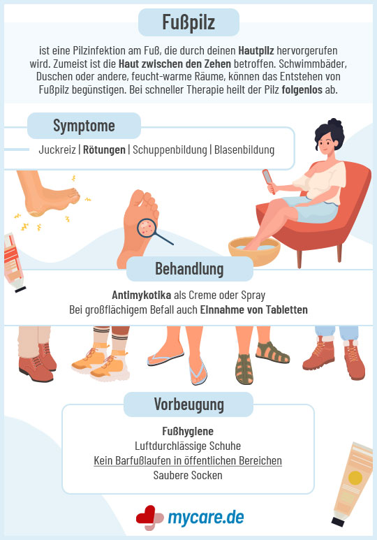 Infografik Fußpilz: Symptome, Behandlung & Vorbeugung