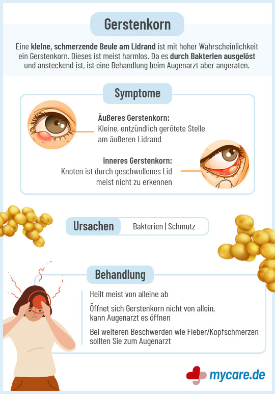 Infografik Gerstenkorn: Symptome, Ursachen, Behandlung