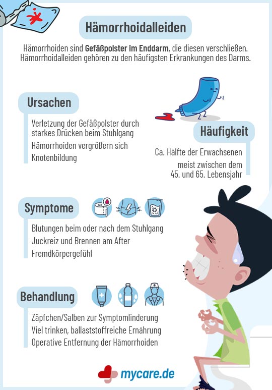 Infografik Hämorrhoiden - Symptome, Vorbeugung & Behandlung