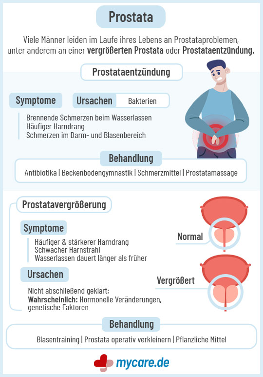 Infografik Prostata: Ursachen und Behandlung von Prostataentzündung und Prostatavergrößerung