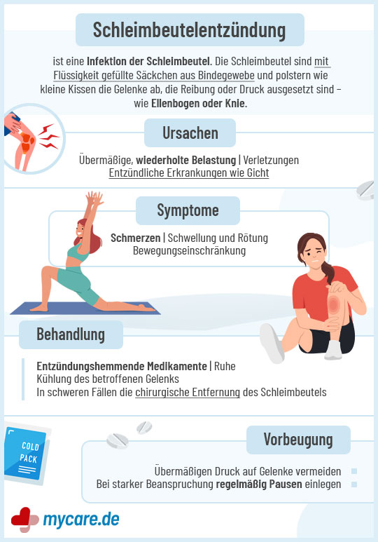 Infografik Schleimbeutelentzündung: Ursachen, Symptome, Behandlung & Vorbeugung