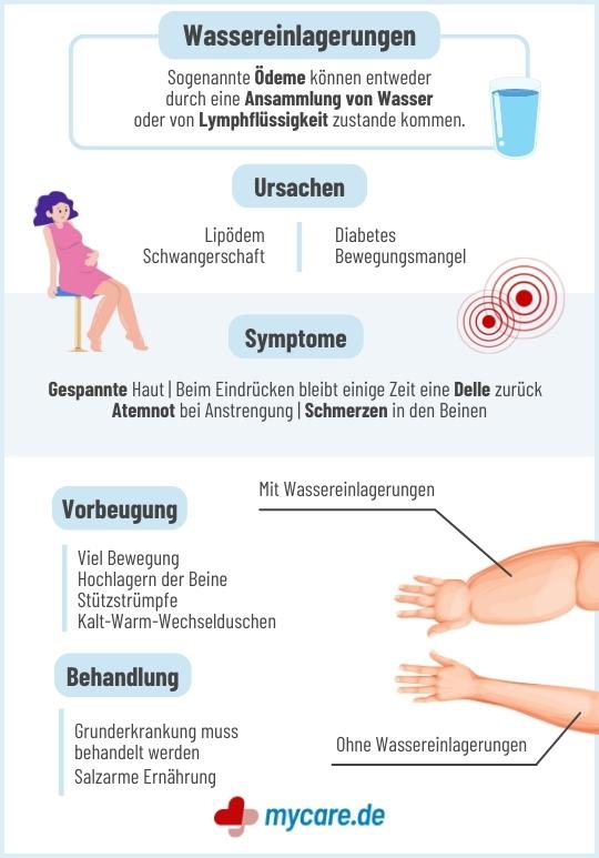 Infografik Wassereinlagerungen: Symptome,Behandlung und Vorbeugung
