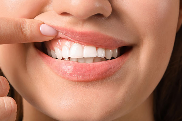 Eine Frau die ihre obere Lippe hoch zieht, um ihre Zähne zu zeigen.