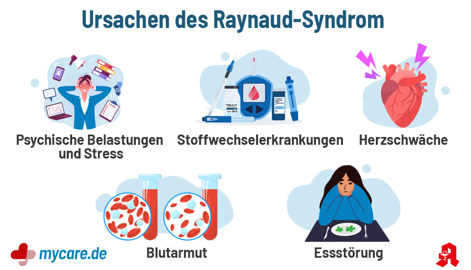 Ursachen des Raynaud-Syndrom: psychische Belastung und Stress, Stoffwechselerkrankungen, Herzschwäche, Blutarmut, Essstörung.